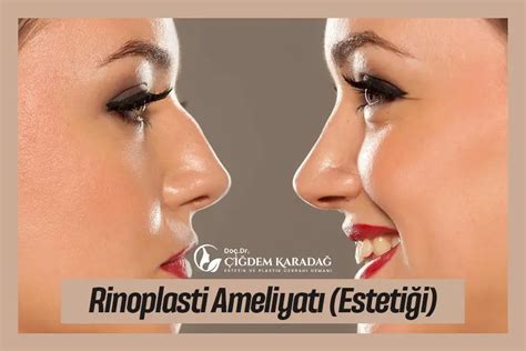 Rinoplasti Ameliyatı: Uzmanından Tavsiyeler ve İpuçları